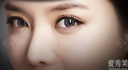 寧波薇琳醫療美容醫院是正規醫院嗎：影響開眼角術效果的因素